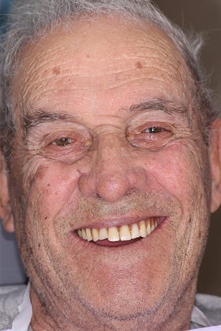 February 2021 male dental patient before treatment