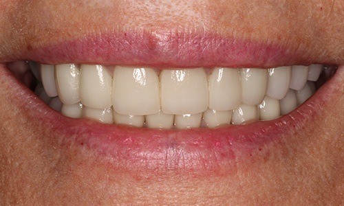 Smile treated by Dr. Mohr in 2019