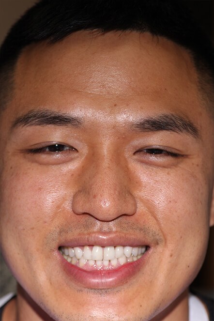 Headshot of June 2021 patient before treatment