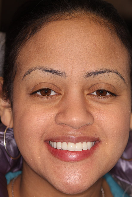 March 2016 smile of the month patient