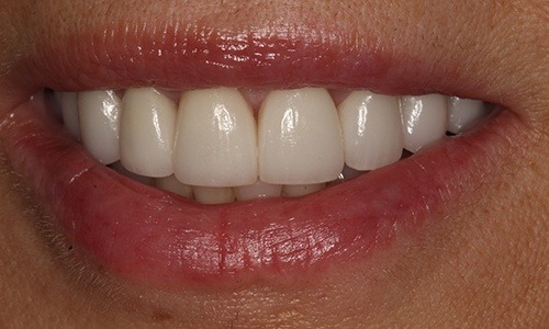 Dental case from March 2017