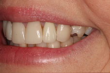 Closeup of Lisa's smile from right before