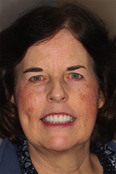 March 2020 smile of the month patient