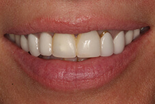 Patient's smile before treatment