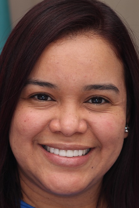 May 2022 patient showing a whiter smile
