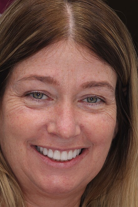 Headshot of woman with straighter, whiter smile