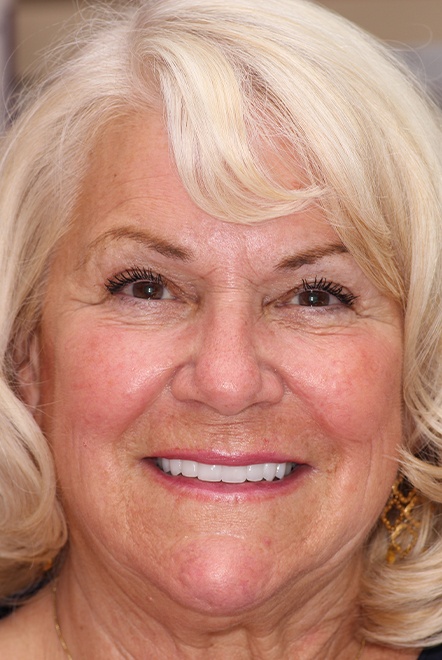 Woman with white hair showing smile after treatment
