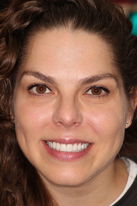 Headshot of Eva after veneers have been placed