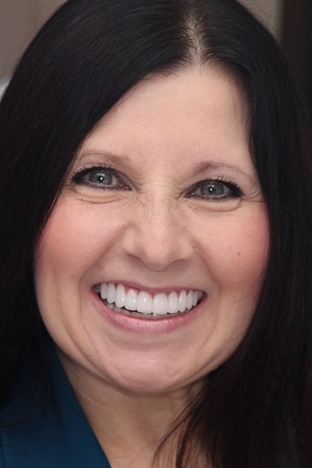 Headshot of October 2021 patient after treatment
