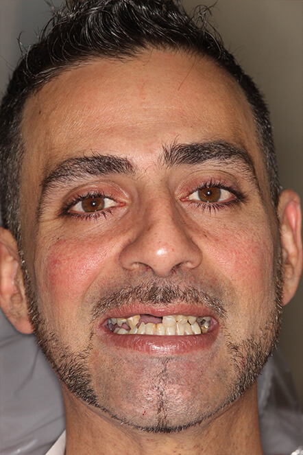 Headshot of James before treatment