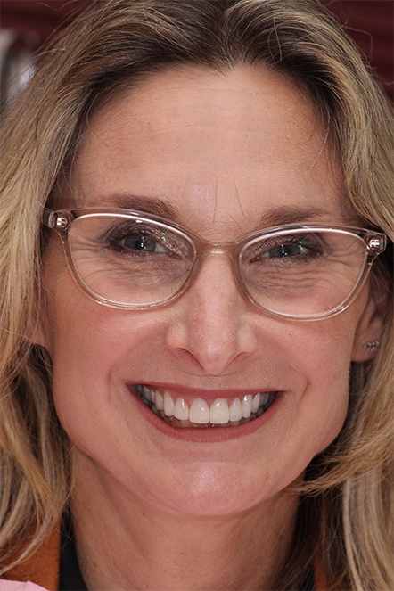 Blonde woman smiling after receiving dental crowns
