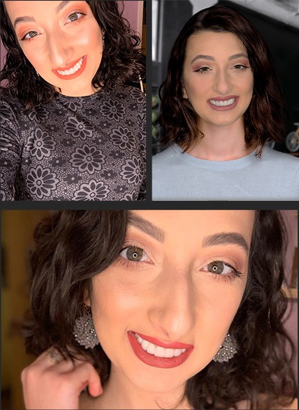 Several shots of Hally with her new smile