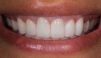 Closeup of Jade after treatment