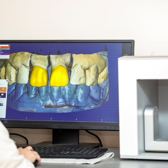 Computer screen showing a digital impression of a row of teeth