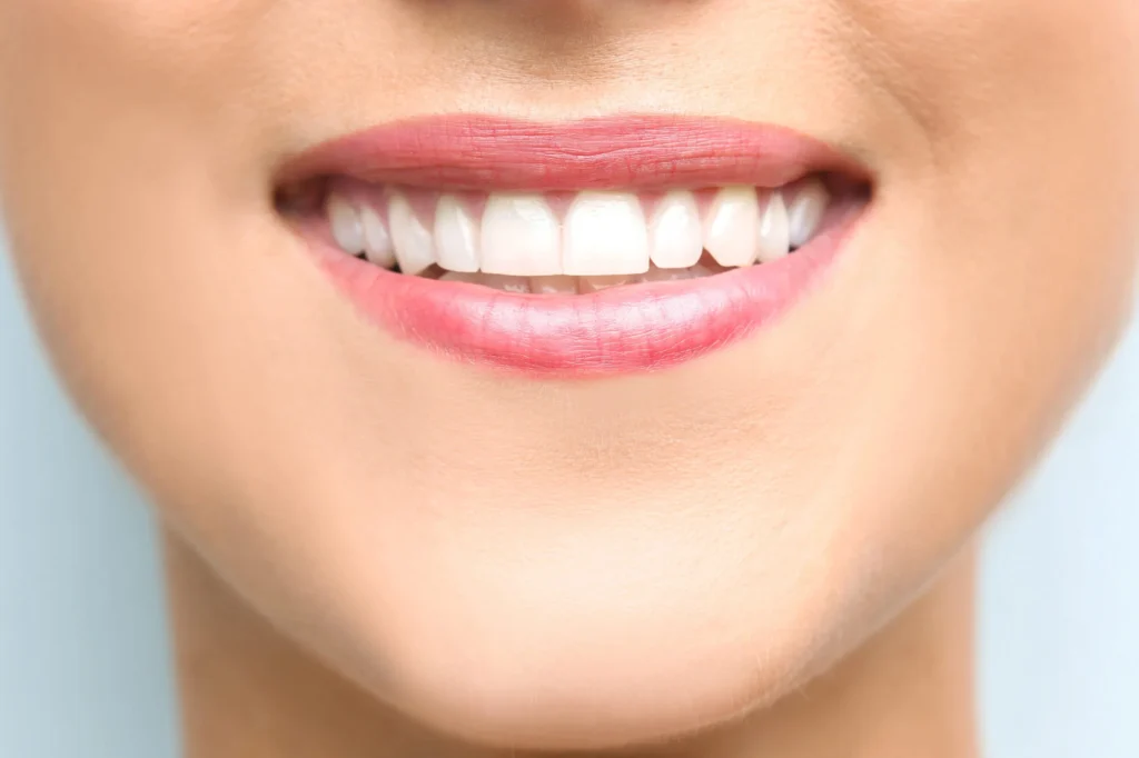 Happy-patient-showing-smile-makeover-in-Massapequa