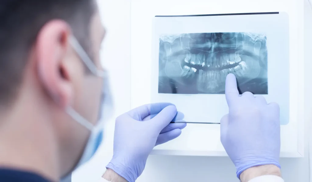 Orthodontist in Massapequa reviewing a patient's dental X-ray