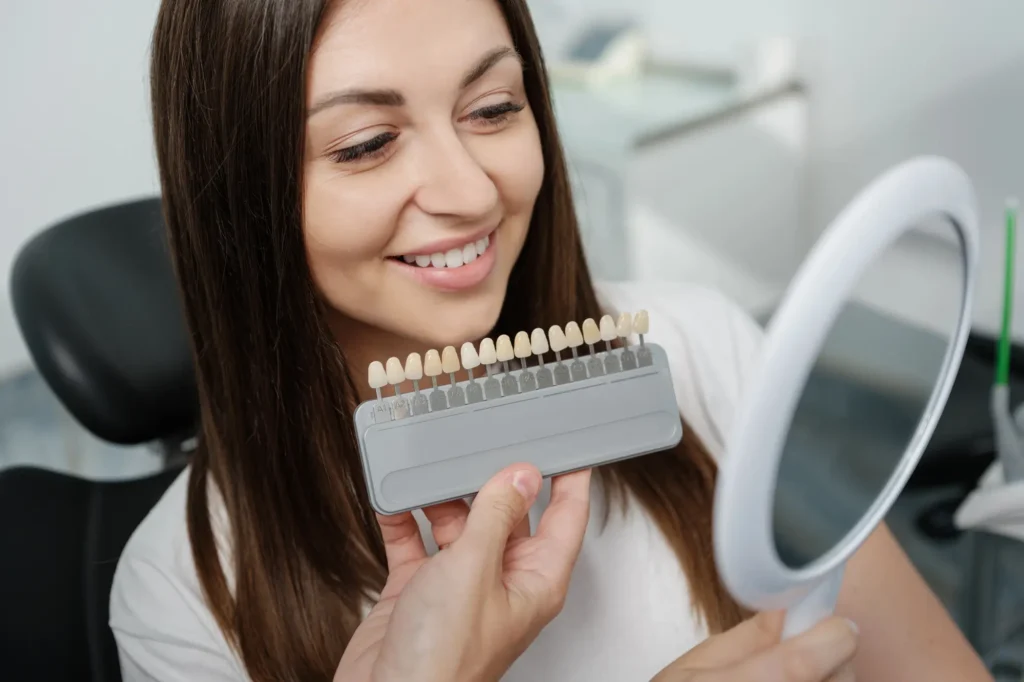 Veneers Massapequa Color Matching Consultation