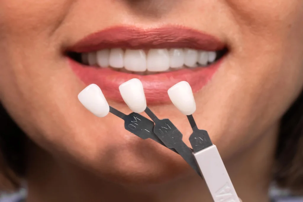 Woman choosing shade for veneers in Massapequa.