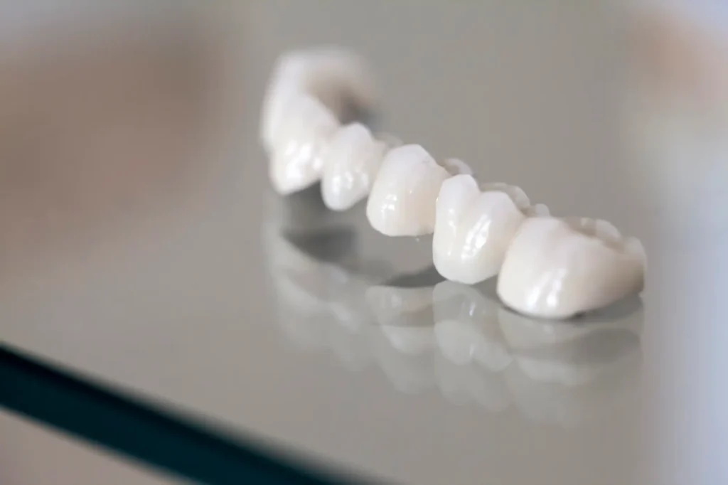 Zirconia dental crowns in Massapequa displayed in a dental clinic