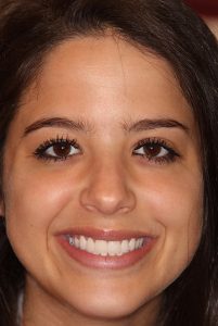 cosmetic dentist in long island transforms smiles